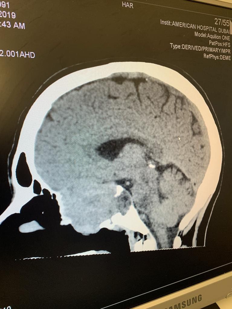 Emily has been told she has 6-9 months to live.